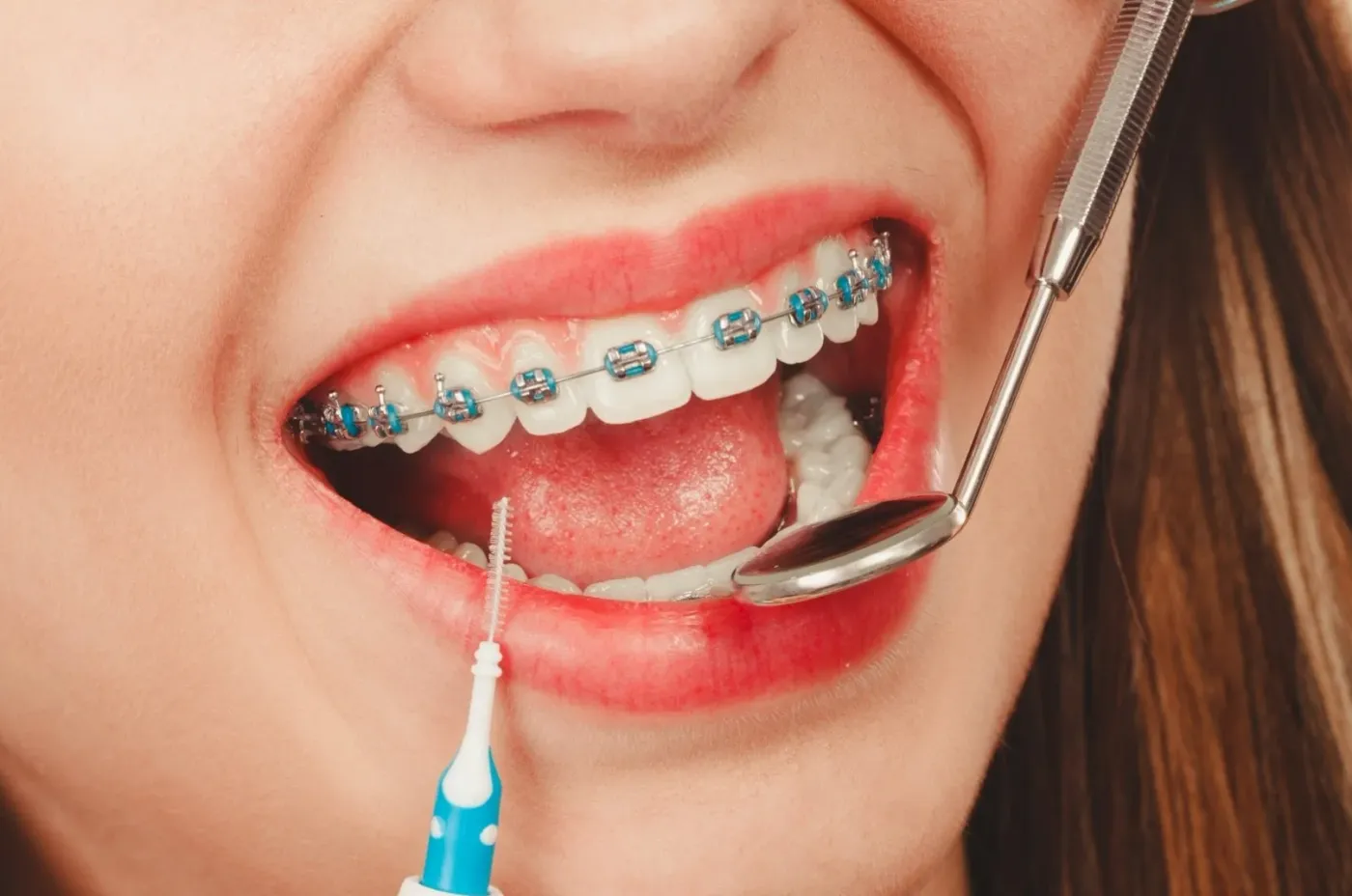 Dentist in North Hollywood